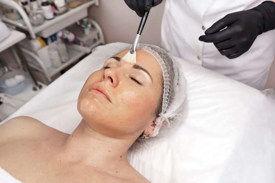 Chemical Peels in Greensboro, NC by Epic Management NC dba Epic Esthetics